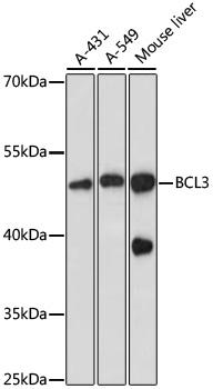 BCL3 / BCL-3 Antibody - Western blot analysis of extracts of various cell lines using BCL3 Polyclonal Antibody at dilution of 1:1000.