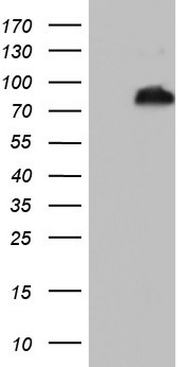 BCL6 Antibody - HEK293T cells were transfected with the pCMV6-ENTRY control (Left lane) or pCMV6-ENTRY BCL6 (Right lane) cDNA for 48 hrs and lysed. Equivalent amounts of cell lysates (5 ug per lane) were separated by SDS-PAGE and immunoblotted with anti-BCL6.