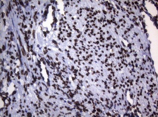 BCL6 Antibody - Immunohistochemical staining of paraffin-embedded Human endometrium tissue using anti-BCL6 mouse monoclonal antibody.