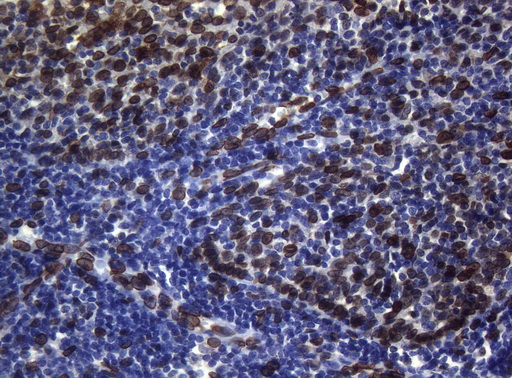 BCL6 Antibody - Immunohistochemical staining of paraffin-embedded Human tonsil using anti-BCL6 mouse monoclonal antibody.
