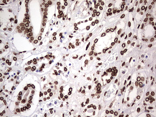 BCL6 Antibody - Immunohistochemical staining of paraffin-embedded Human Kidney tissue using anti-BCL6 mouse monoclonal antibody.