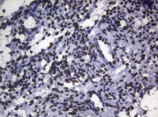 BCL6 Antibody - Immunohistochemical staining of paraffin-embedded Human Ovary tissue using anti-BCL6 mouse monoclonal antibody.
