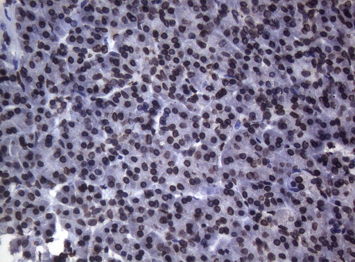 BCL6 Antibody - Immunohistochemical staining of paraffin-embedded Human pancreas tissue using anti-BCL6 mouse monoclonal antibody.