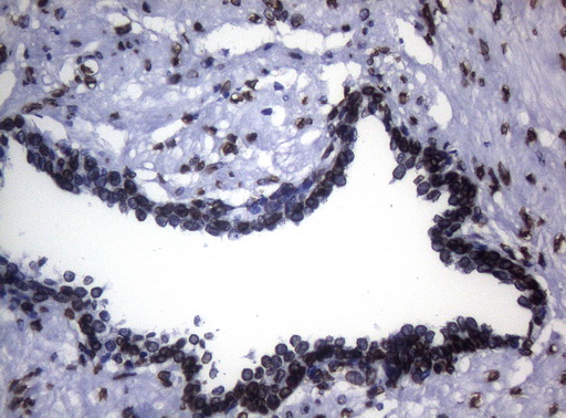 BCL6 Antibody - Immunohistochemical staining of paraffin-embedded Human prostate tissue using anti-BCL6 mouse monoclonal antibody. (1:150)