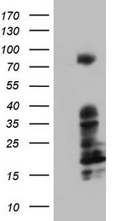 BCL6 Antibody - HEK293T cells were transfected with the pCMV6-ENTRY control (Left lane) or pCMV6-ENTRY BCL6 (Right lane) cDNA for 48 hrs and lysed. Equivalent amounts of cell lysates (5 ug per lane) were separated by SDS-PAGE and immunoblotted with anti-BCL6.