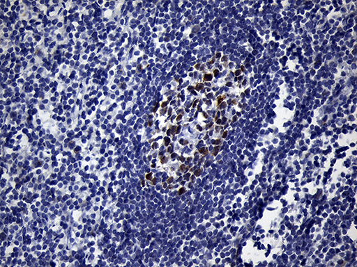 BCL6 Antibody - Immunohistochemical staining of paraffin-embedded Human lymph node tissue within the normal limits using anti-BCL6 mouse monoclonal antibody. (Heat-induced epitope retrieval by 1mM EDTA in 10mM Tris buffer. (pH8.5) at 120°C for 3 min. (1:500)