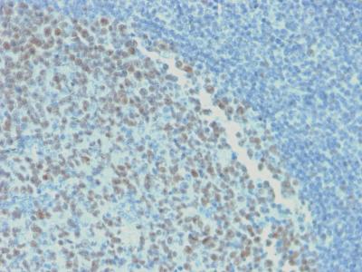 BCL6 Antibody - Formalin-fixed, paraffin-embedded human Tonsil stained with BCL-6 Mouse Recombinant Monoclonal Antibody (rBCL6/1718).