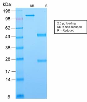 BCL6 Antibody - SDS-PAGE Analysis Purified BCL-6 Mouse Recombinant Monoclonal Antibody (rBCL6/1718). Confirmation of Purity and Integrity of Antibody.