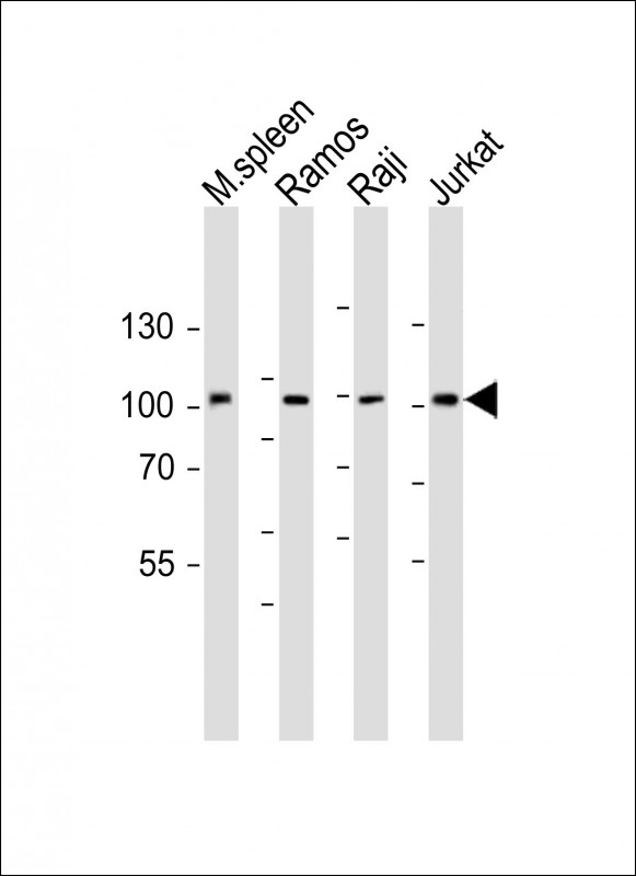 BCL6 Antibody - All lanes: Anti-BCL6 Antibody (Center) at 1:1000 dilution. Lane 1: mouse spleen lysate. Lane 2: Ramos whole cell lysate. Lane 3: Raji whole cell lysate. Lane 4: Jurkat whole cell lysate Lysates/proteins at 20 ug per lane. Secondary Goat Anti-Rabbit IgG, (H+L), Peroxidase conjugated at 1:10000 dilution. Predicted band size: 79 kDa. Blocking/Dilution buffer: 5% NFDM/TBST.