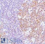 BCL6 Antibody - Immunohistochemistry of Human tonsil stained with anti-BCL-6 antibody