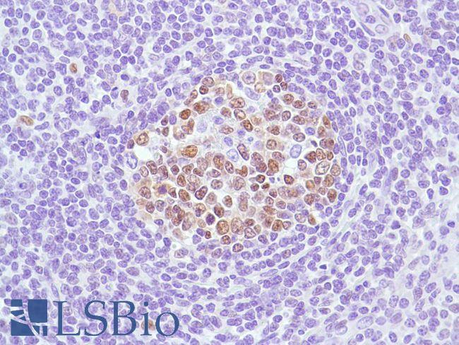 BCL6 Antibody - Immunohistochemistry of Human Tonsil stained with anti-BCL-6 antibody