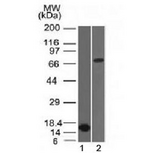 BCL6 Antibody - Western blot testing of 1) partial recombinant protein and 2) human HepG2 lysate with Bcl6 antibody (clone BCL6/1475). Expected molecular weight: 78/95kDa (non-phosphorylated/phosphorylated).