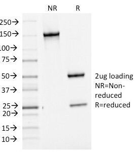 BCL6 Antibody - SDS-PAGE Analysis of Purified, BSA-Free Bcl6 Antibody (clone BCL6/1475). Confirmation of Integrity and Purity of the Antibody.