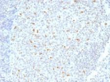 BCL6 Antibody - IHC testing of FFPE human tonsil tissue with Bcl6 antibody (clone BCL6/1526). Required HIER: boil tissue sections in 10mM Tris with 1mM EDTA, pH 9, for 10-20 min.