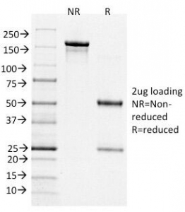 BCL6 Antibody - SDS-PAGE Analysis of Purified, BSA-Free Bcl6 Antibody (clone BCL6/1526). Confirmation of Integrity and Purity of the Antibody.