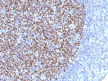 BCL6 Antibody - IHC testing of FFPE human tonsil tissue with Bcl6 antibody (clone BCL6/1527). Required HIER: boil tissue sections in 10mM Tris with 1mM EDTA, pH 9, for 10-20 min.
