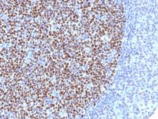 BCL6 Antibody - IHC testing of FFPE human tonsil tissue with Bcl6 antibody (clone BCL6/1527). Required HIER: boil tissue sections in 10mM Tris with 1mM EDTA, pH 9, for 10-20 min.