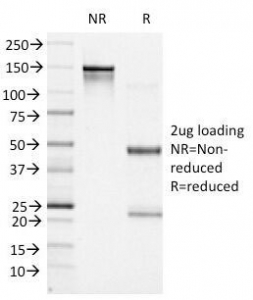 BCL6 Antibody - SDS-PAGE Analysis of Purified, BSA-Free Bcl6 Antibody (clone BCL6/1527). Confirmation of Integrity and Purity of the Antibody.