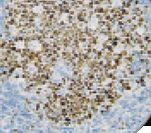 BCL6 Antibody - IHC of bcl-6 on FFPE Tonsil tissue. This image was taken for the unmodified form of this product. Other forms have not been tested.