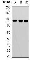 BCL6 Antibody - Western blot analysis of BCL6 expression in HeLa (A); mouse heart (B); mouse brain (C) whole cell lysates.