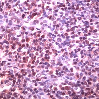 BCL6 Antibody - Human tonsil stained with Anti-Bcl-6,cat# E14094
