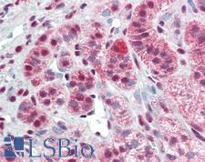 BCL6 Antibody - Adrenal: Formalin-Fixed, Paraffin-Embedded (FFPE)