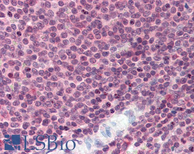 BCL6 Antibody - Spleen: Formalin-Fixed, Paraffin-Embedded (FFPE)