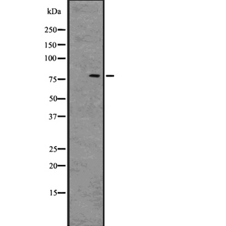 BCL6 Antibody - Western blot analysis of BCL-6 using HuvEc whole cells lysates
