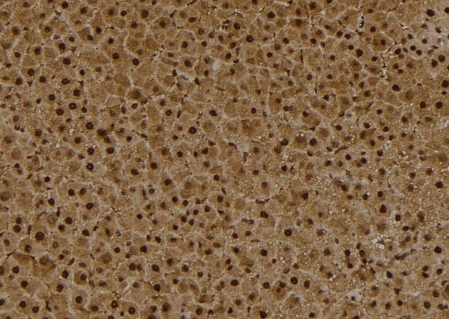 BCL6 Antibody - 1:100 staining rat liver tissue by IHC-P. The sample was formaldehyde fixed and a heat mediated antigen retrieval step in citrate buffer was performed. The sample was then blocked and incubated with the antibody for 1.5 hours at 22°C. An HRP conjugated goat anti-rabbit antibody was used as the secondary.