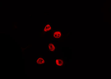 BCL6 Antibody - Staining HepG2 cells by IF/ICC. The samples were fixed with PFA and permeabilized in 0.1% Triton X-100, then blocked in 10% serum for 45 min at 25°C. The primary antibody was diluted at 1:200 and incubated with the sample for 1 hour at 37°C. An Alexa Fluor 594 conjugated goat anti-rabbit IgG (H+L) Ab, diluted at 1/600, was used as the secondary antibody.