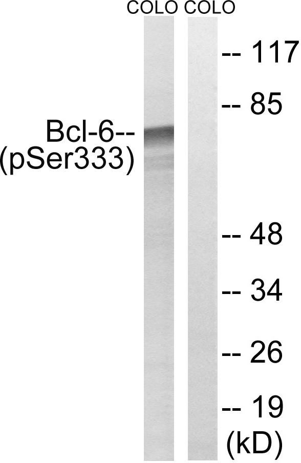 BCL6 Antibody - Western blot analysis of lysates from COLO205 cells treated with insulin 0.01U/ml 15', using Bcl-6 (Phospho-Ser333) Antibody. The lane on the right is blocked with the phospho peptide.
