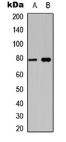 BCL6 Antibody - Western blot analysis of BCL6 (pS333) expression in Jurkat (A); mouse brain (B) whole cell lysates.