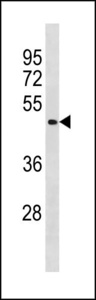 BCL6B Antibody - BCL6B Antibody western blot of A549 cell line lysates (35 ug/lane). The BCL6B antibody detected the BCL6B protein (arrow).