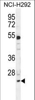 BCL7A Antibody - BCL7A Antibody western blot of NCI-H292 cell line lysates (35 ug/lane). The BCL7A antibody detected the BCL7A protein (arrow).