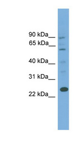 BCL7A Antibody - BCL7A antibody Western blot of 721_B cell lysate. This image was taken for the unconjugated form of this product. Other forms have not been tested.