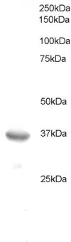 BCL7A Antibody - Antibody staining (0.5 ug/ml) of HeLa lysate (RIPA buffer, 35 ug total protein per lane). Primary incubated for 1 hour. Detected by Western blot of chemiluminescence.