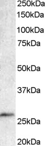 BCL7A Antibody - BCL7A antibody staining (1ug/ml) of Human lymph node lysate (RIPA buffer, 35ug total protein per lane). Primary incubated for 1 hour. Detected by western blot using chemiluminescence.