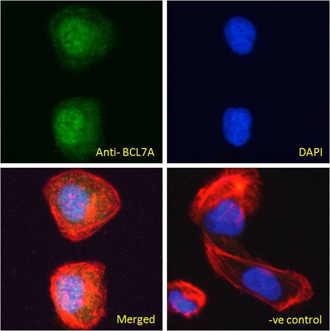 BCL7A Antibody - BCL7A antibody immunofluorescence analysis of paraformaldehyde fixed U2OS cells, permeabilized with 0.15% Triton. Primary incubation 1hr (10ug/ml) followed by Alexa Fluor 488 secondary antibody (2ug/ml), showing nuclear staining. Actin filaments were stained with phalloidin (red) and The nuclear stain is DAPI (blue). Negative control: Unimmunized goat IgG (10ug/ml) followed by Alexa Fluor 488 secondary antibody (2ug/ml).