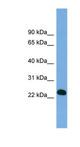 BCL7A Antibody - BCL7A antibody Western blot of Fetal lung lysate. This image was taken for the unconjugated form of this product. Other forms have not been tested.