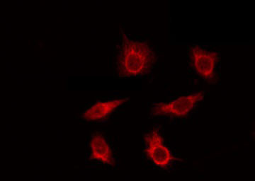 BCL7A Antibody - Staining HuvEc cells by IF/ICC. The samples were fixed with PFA and permeabilized in 0.1% Triton X-100, then blocked in 10% serum for 45 min at 25°C. The primary antibody was diluted at 1:200 and incubated with the sample for 1 hour at 37°C. An Alexa Fluor 594 conjugated goat anti-rabbit IgG (H+L) Ab, diluted at 1/600, was used as the secondary antibody.