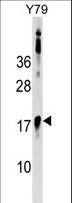 BCL7B Antibody - BCL7B Antibody western blot of Y79 cell line lysates (35 ug/lane). The BCL7B antibody detected the BCL7B protein (arrow).