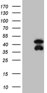 BCL7B Antibody - HEK293T cells were transfected with the pCMV6-ENTRY control. (Left lane) or pCMV6-ENTRY BCL7B. (Right lane) cDNA for 48 hrs and lysed. Equivalent amounts of cell lysates. (5 ug per lane) were separated by SDS-PAGE and immunoblotted with anti-BCL7B. (1:2000)
