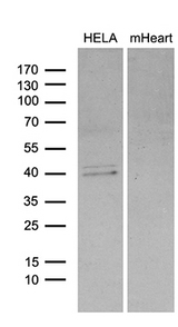 BCL7B Antibody - Western blot analysis of extracts. (35ug) from HELA cell line and mouse heart tissue lysate by using anti-BCL7B monoclonal antibody. (1:500)