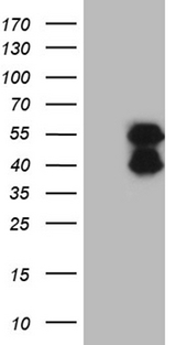 BCL7B Antibody - HEK293T cells were transfected with the pCMV6-ENTRY control. (Left lane) or pCMV6-ENTRY BCL7B. (Right lane) cDNA for 48 hrs and lysed