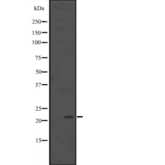 BCL7B Antibody - Western blot analysis of BCL-7B expression in Y79 cells line lysates. The lane on the left is treated with the antigen-specific peptide.