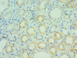 BCL7C Antibody - Immunohistochemistry of paraffin-embedded human kidney tissue using BCL7C Antibody at dilution of 1:100