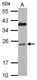 BCL7C Antibody - Sample (30 ug of whole cell lysate) A: Jurkat 12% SDS PAGE BCL7C antibody diluted at 1:1000