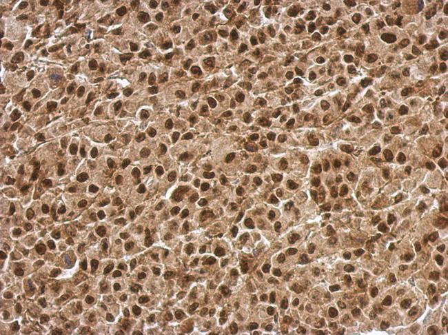 BCL7C Antibody - IHC of paraffin-embedded HBL435 xenograft, using BCL7C antibody at 1:500 dilution.