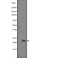 BCL7C Antibody - Western blot analysis of BCL-7C expression in Jurkat whole cells lysate. The lane on the left is treated with the antigen-specific peptide.