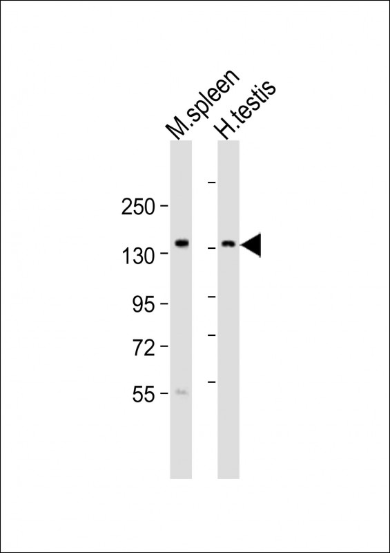 BCL9 Antibody - All lanes: Anti-BCL9 Antibody (N-Term) at 1:2000 dilution. Lane 1: mouse spleen lysates. Lane 2: human testis lysates Lysates/proteins at 20 ug per lane. Secondary Goat Anti-Rabbit IgG, (H+L), Peroxidase conjugated at 1:10000 dilution. Predicted band size: 149 kDa. Blocking/Dilution buffer: 5% NFDM/TBST.